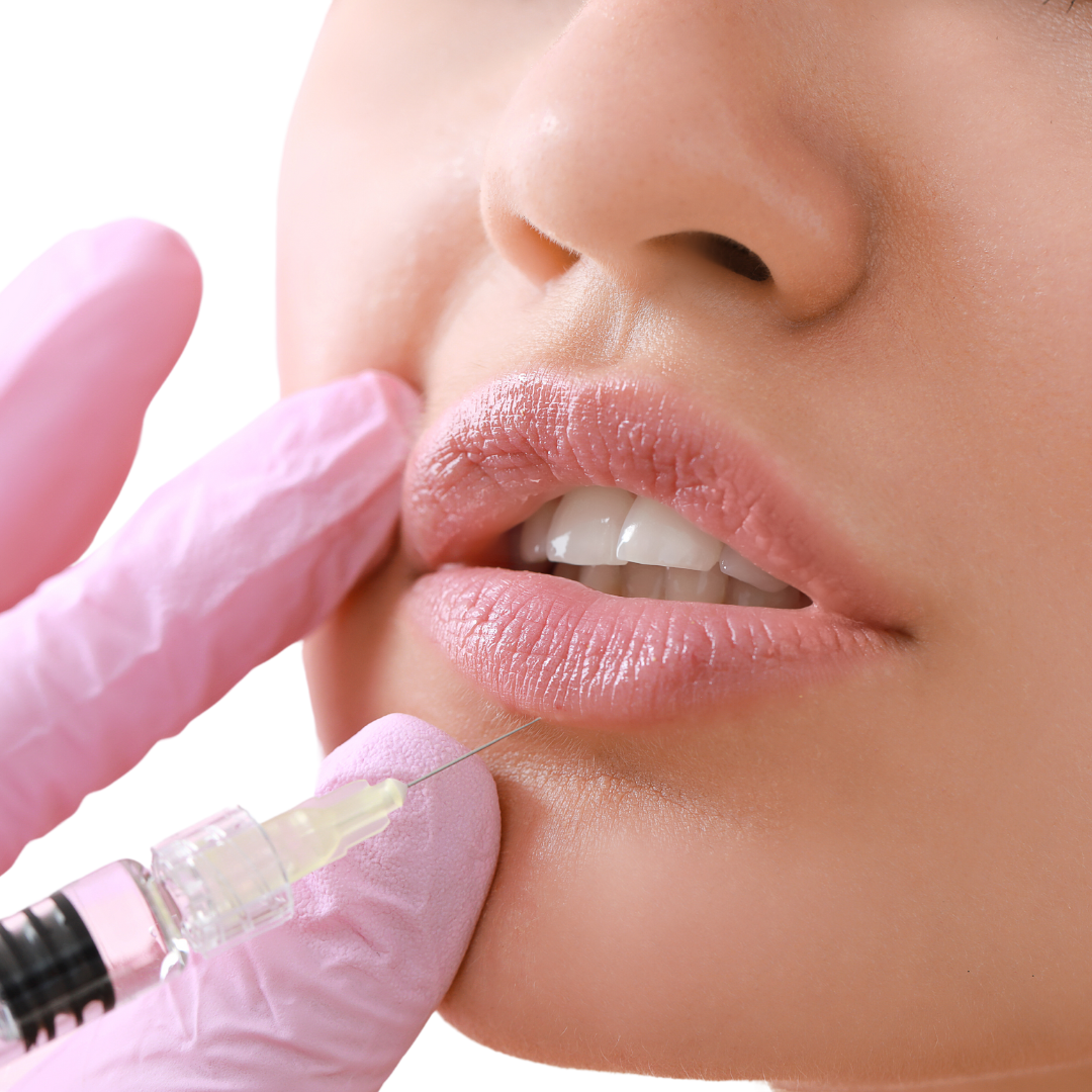 Classic Lip Filler In Wonderland